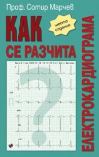 Как се разчита електрокардиограма