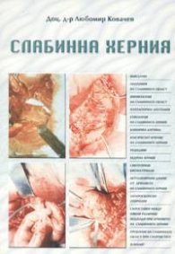Слабинна херния