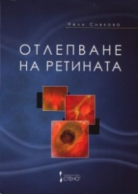 Отлепване на ретината