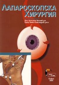 Лапароскопска хирургия