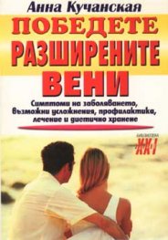 Победете разширените вени
