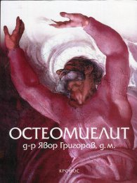 Остеомиелит